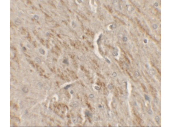 Immunohistochemistry of KAT5