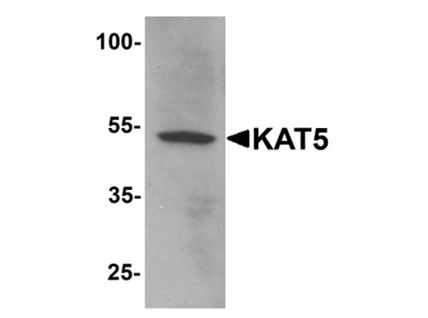 Western blot analysis of KAT5