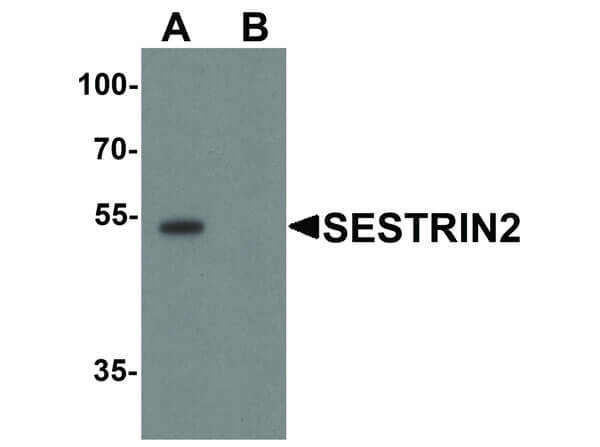 Western Blot of SESTRIN2 Antibody