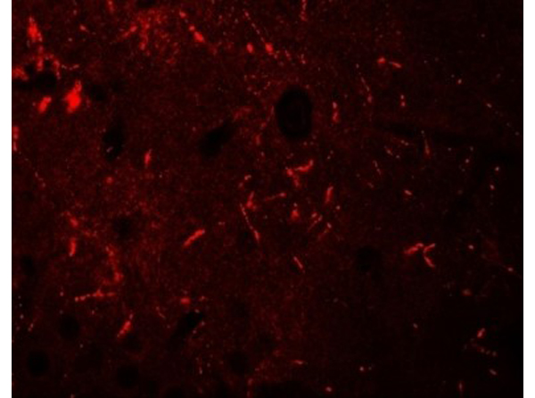 Immunofluorescence of KCNK12