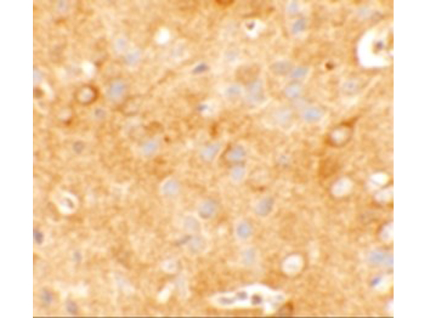 Immunohistochemistry of KCNK12