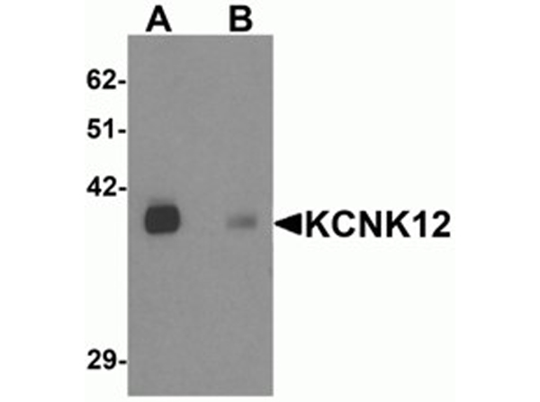 Western blot analysis of KCNK12