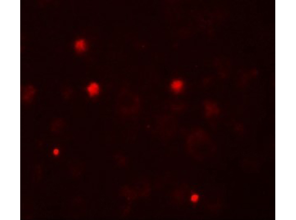 Immunofluorescence of KCNK13