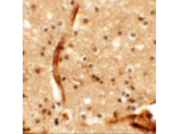Immunohistochemistry of KCNK13