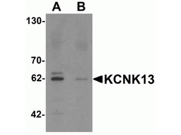 Western blot analysis of KCNK13