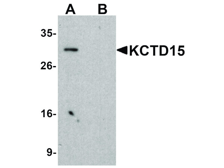 Western Blot of KCTD15 Antibody