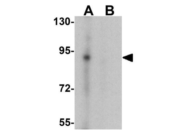 Western blot of KDM1B