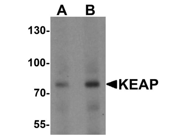 Western Blot of Anti-KEAP1 Antibody
