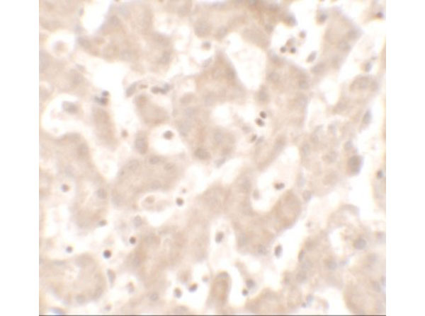 Immunohistochemistry of KHDC1