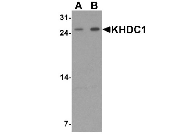 Western blot of KHDC1