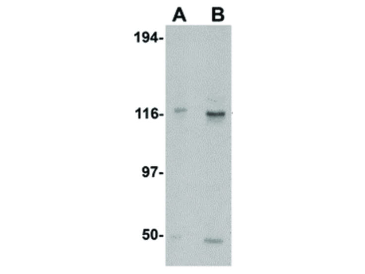 Western Blot of KIF5 Antibody