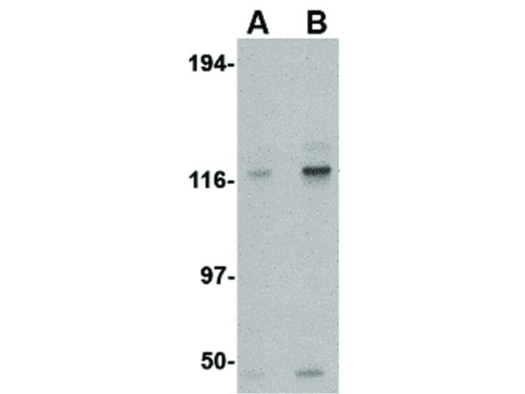 Western Blot of KIF5 Antibody