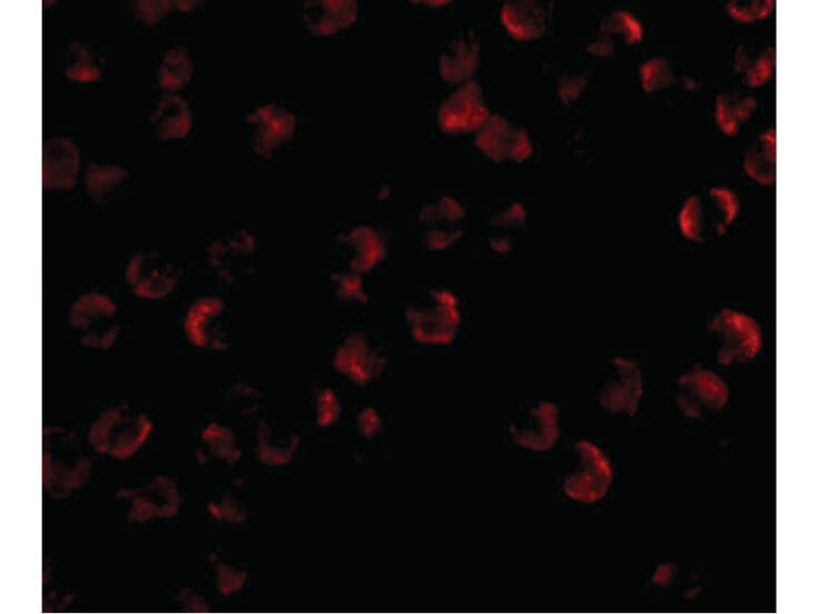 Immunofluorescence of KIF5 Antibody