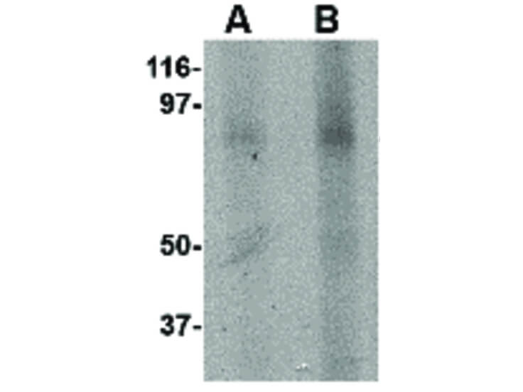 Western Blot of KINDLIN3 Antibody