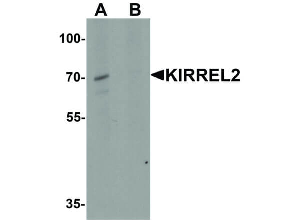 Western Blot of KIRREL2 Antibody