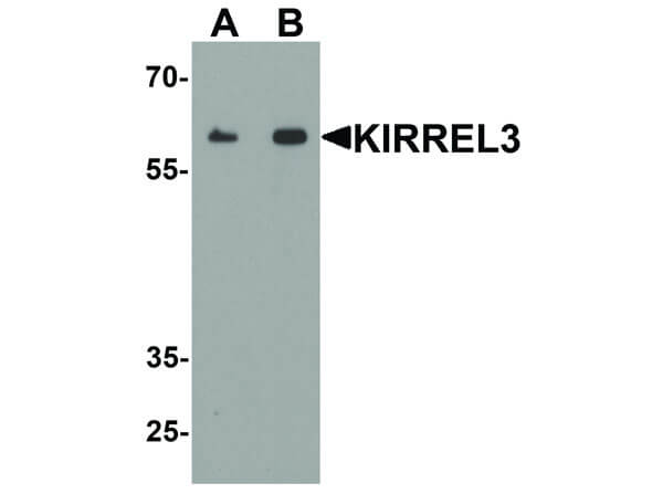 Western Blot of KIRREL3 Antibody