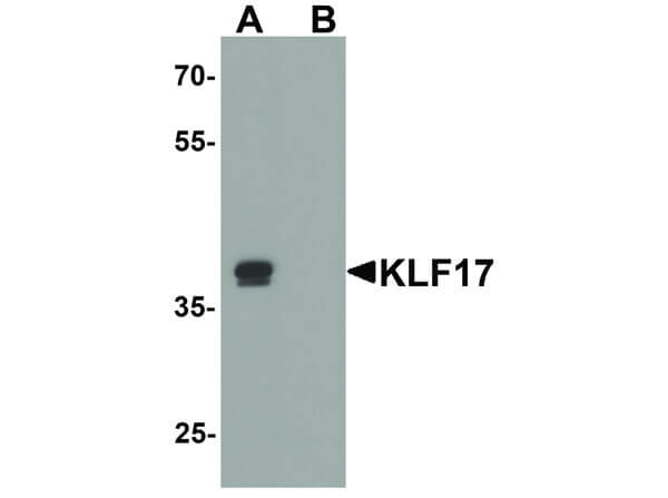 Western Blot of KLF17 Antibody