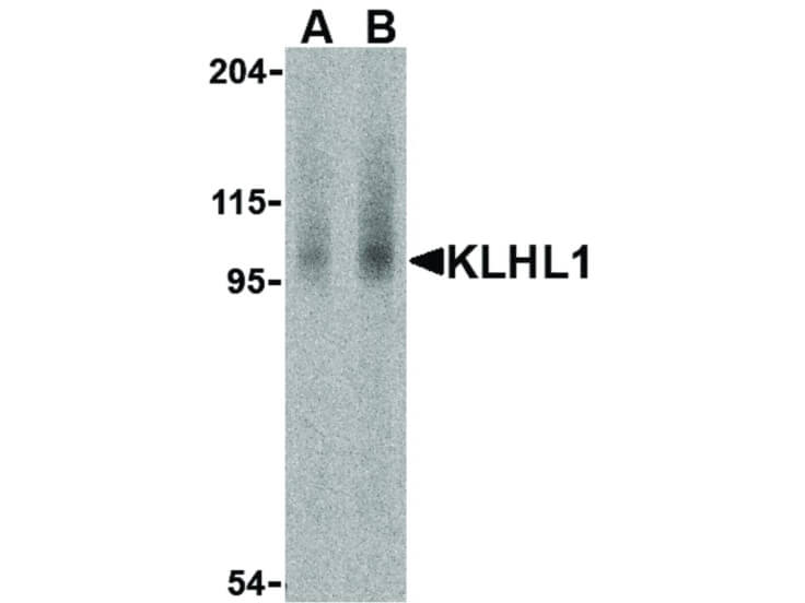 Western Blot of KLHL1 Antibody