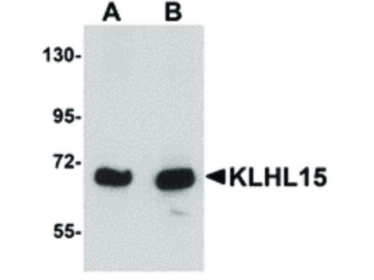 Western Blot of KLHL15 Antibody