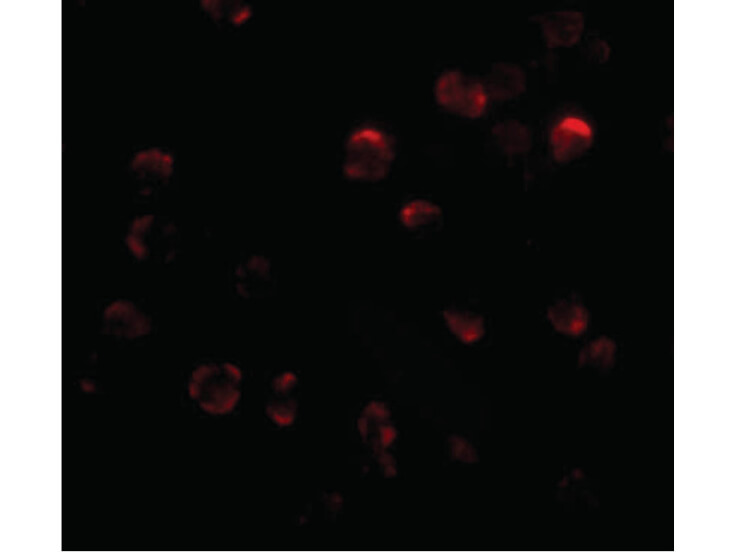 Immunofluorescence Microscopy of KLHL15 antibody