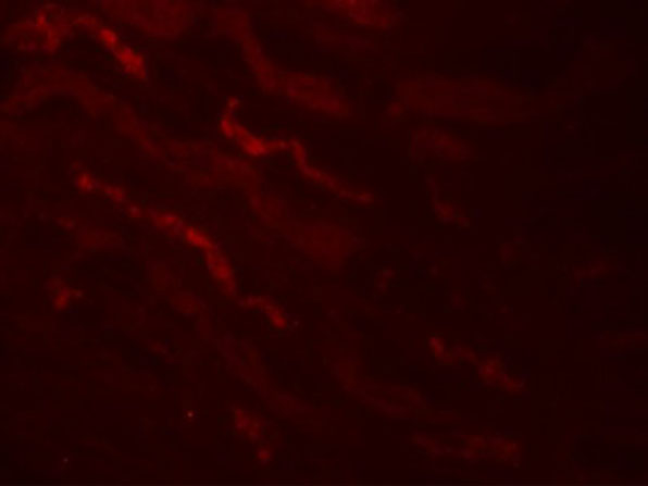 Immunofluorescence of KLK4