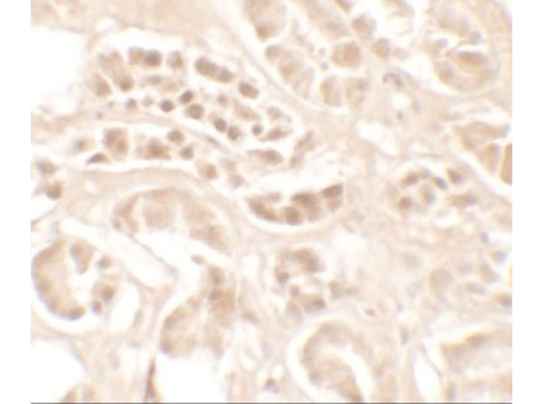 Immunohistochemistry of KLK4