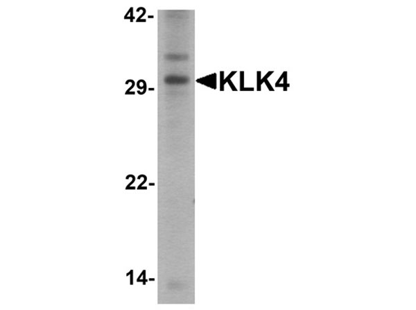 Western blot of KLK4