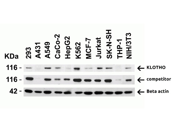 Western Blot Validation