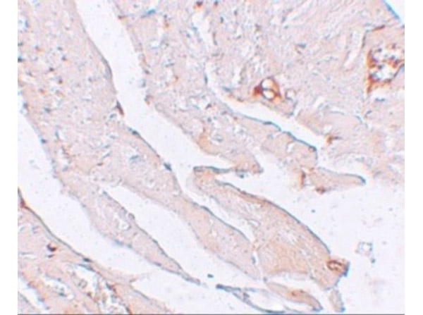 Immunohistochemistry Validation of KLOTHO