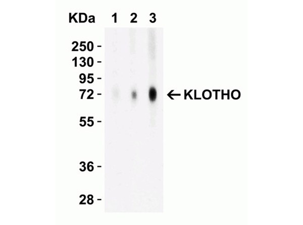 Western Blot Validation