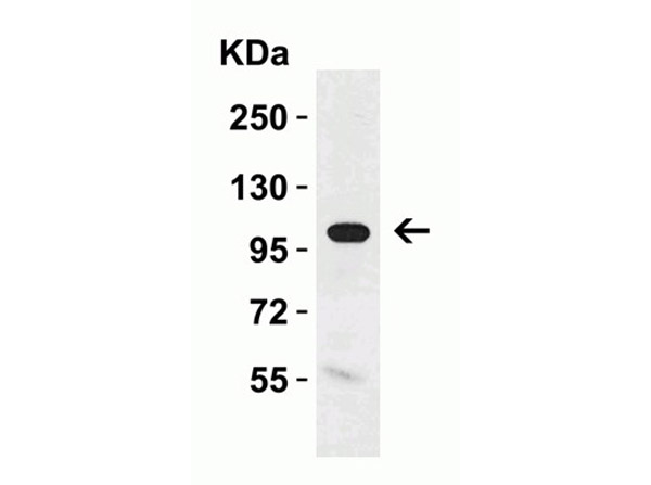 Western Blot Validation