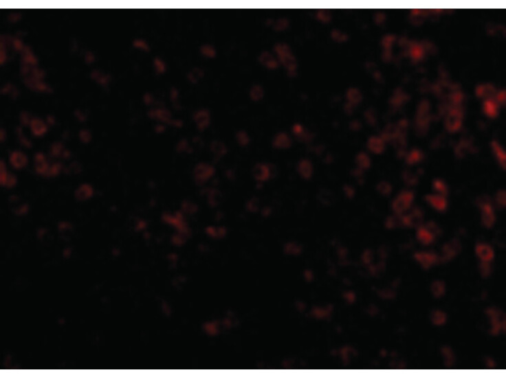 Immunofluorescence of KLRA1 Antibody