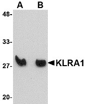 Western blot analysis of KLRA1