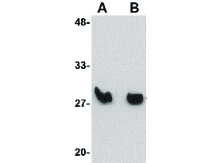 Western Blot of KLRA1 Antibody
