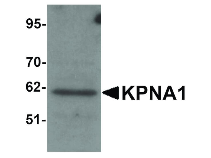 Western Blot of KPNA1 Antibody