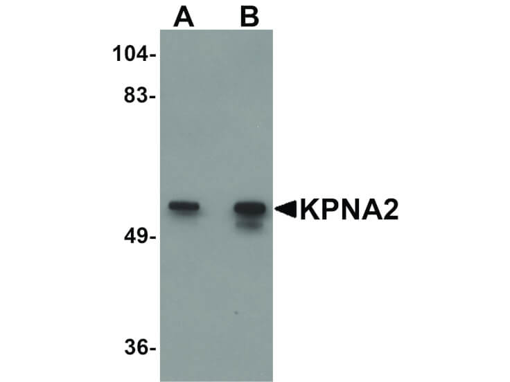 Western Blot of KPNA2 Antibody