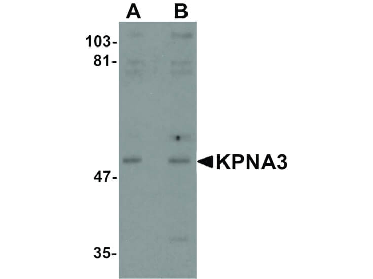 Western Blot of KPNA3 Antibody
