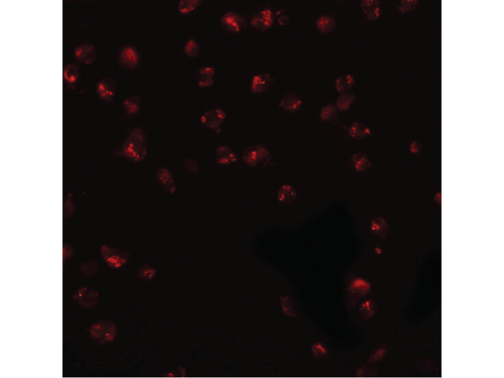 Immunofluorescence of KPNA3 Antibody