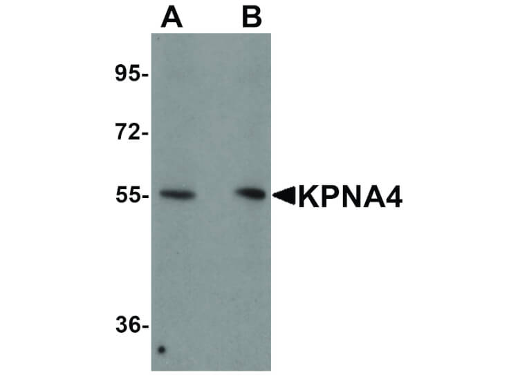 Western Blot of KPNA4 Antibody