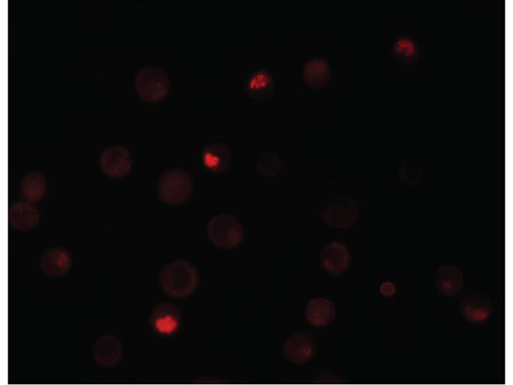 Immunofluorescence of KPNA4 Antibody