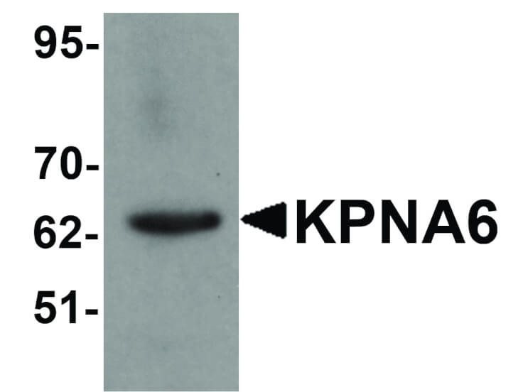 Western Blot of KPNA6 Antibody