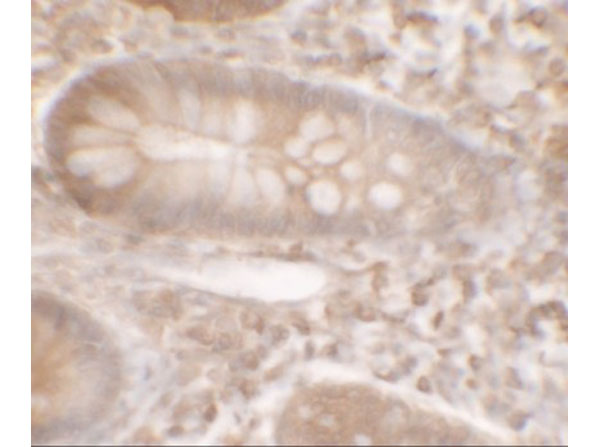 Immunohistochemistry of KREMEN1