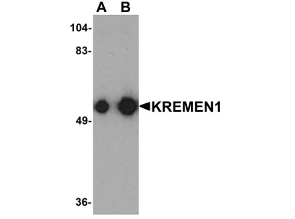 Western blot analysis of KREMEN1