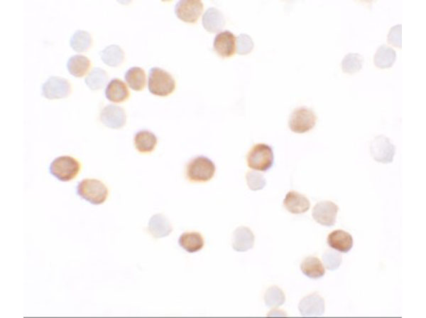 Immunocytochemistry of KREMEN2