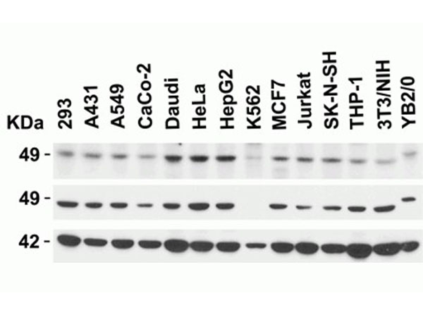 Western Blot of KREMEN2