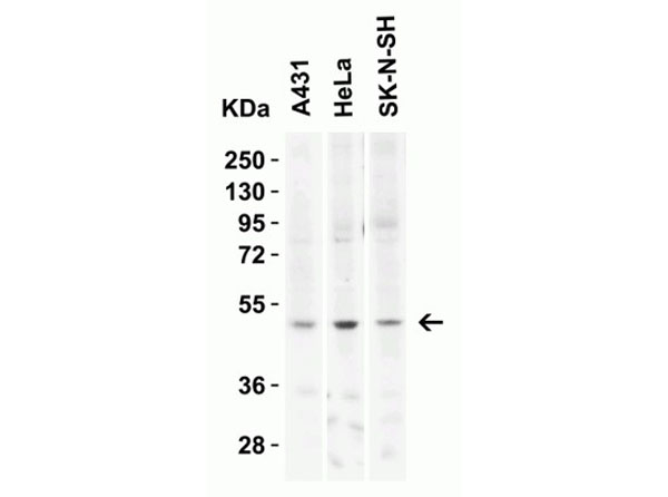 Western Blot of KREMEN2