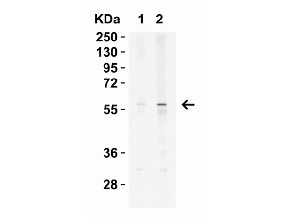 Western Blot of KREMEN2