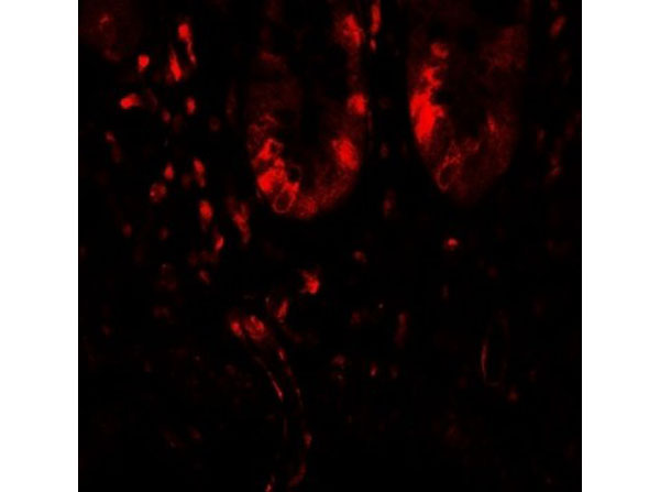 Immunofluorescence of LAMTOR1