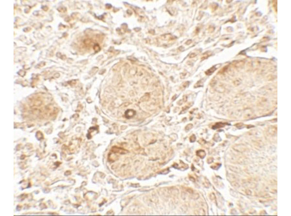 Immunohistochemistry of LAMTOR1