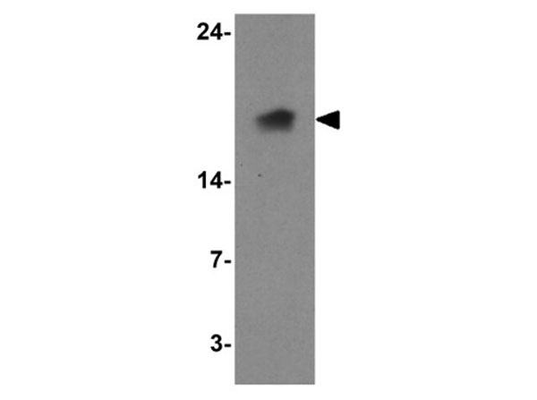 Western blot of LAMTOR1